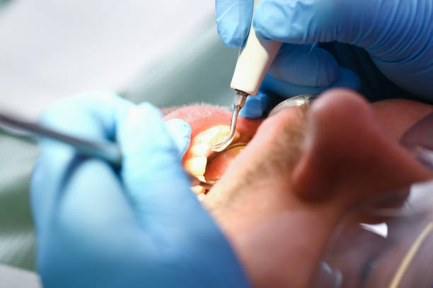 Best Broken or Cracked Tooth Emergency Dentist in Morrisville, NC